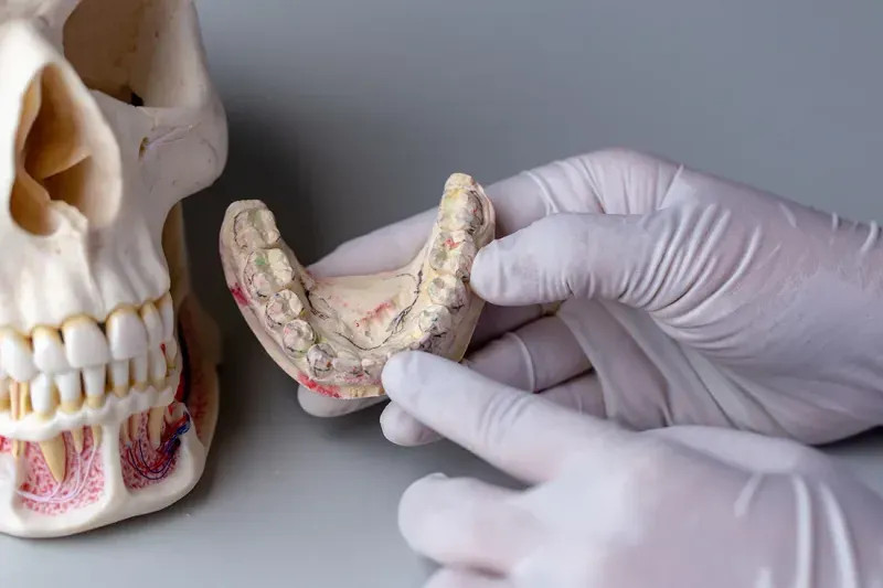 Dental model showing tori