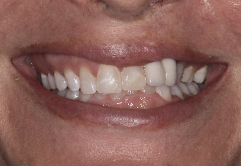 Before smile makeover