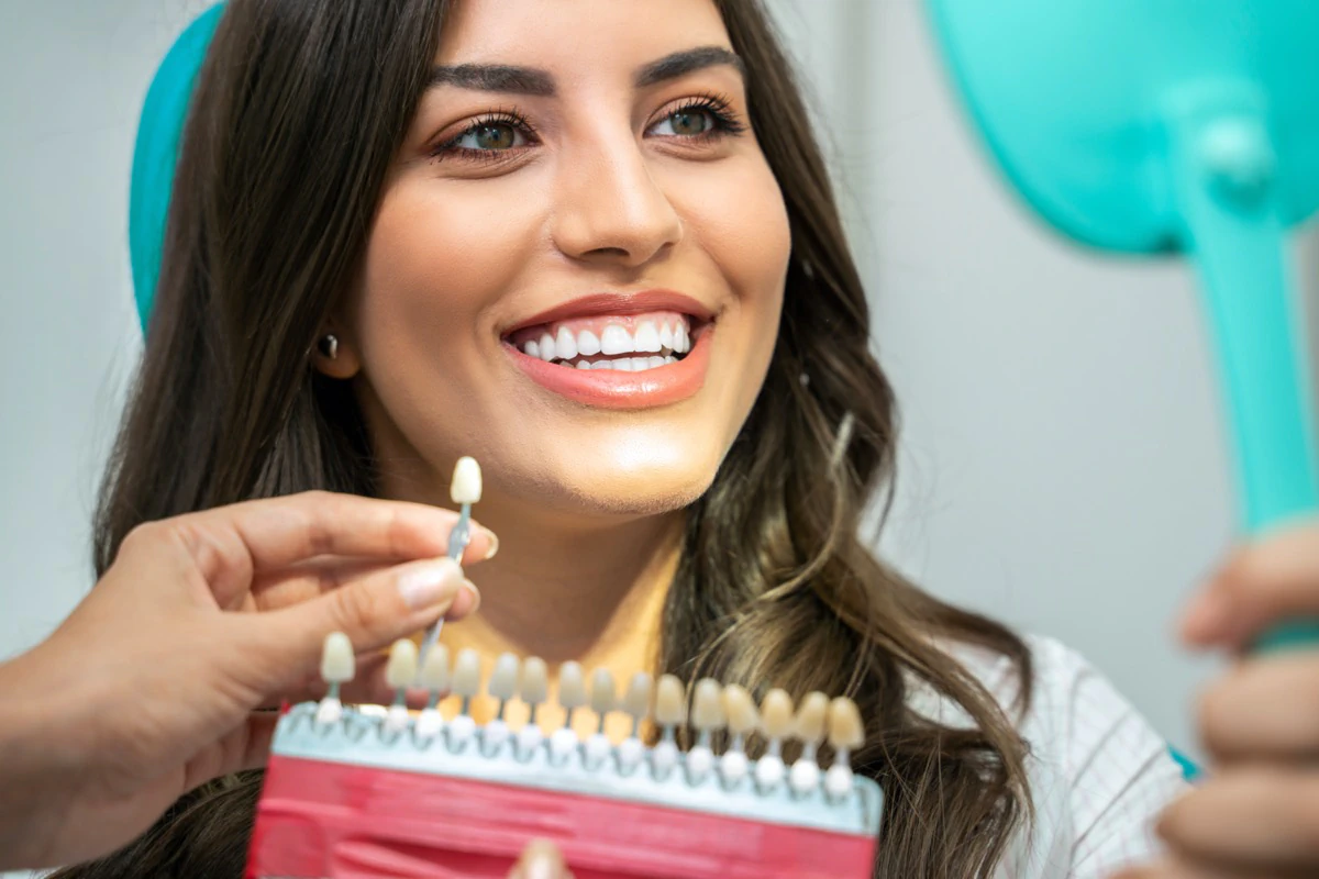 Shades of teeth whitening